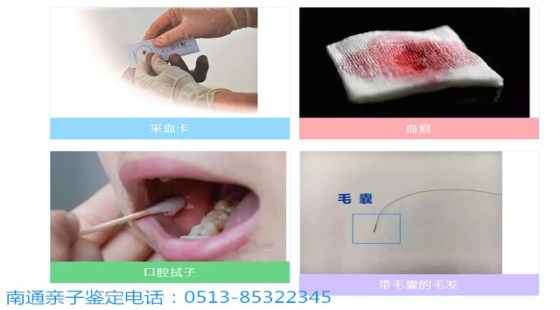 科学辨真相，温柔护亲情！亲子鉴定，治愈所有家庭心结