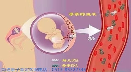 南通亲子鉴定：以专业科学，化解家庭心结
